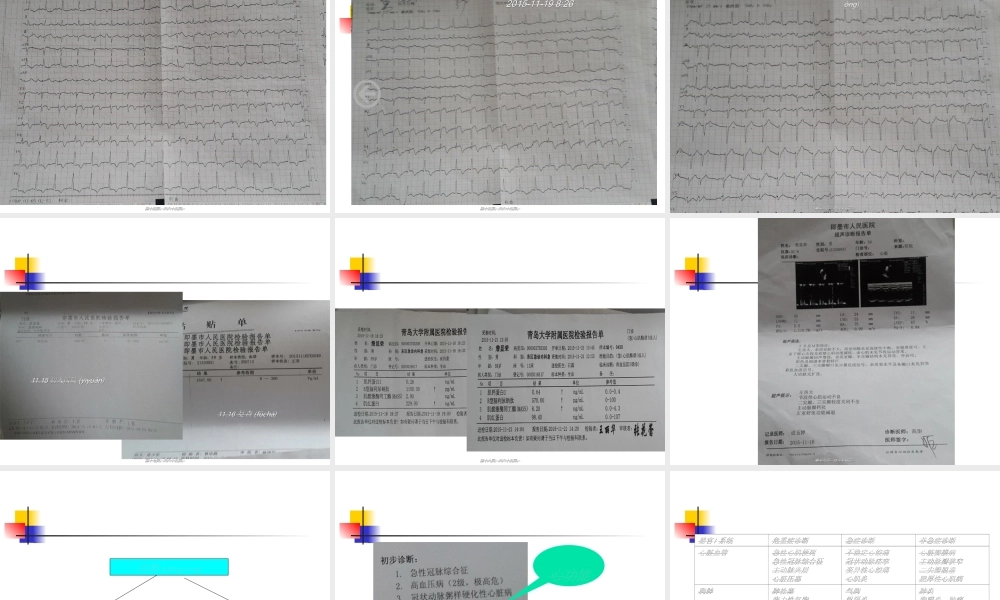 2022年医学专题—急性冠脉综合征教学查房.ppt