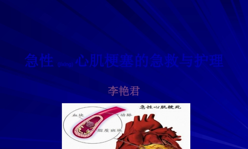 2022年医学专题—急性心肌梗死2.ppt