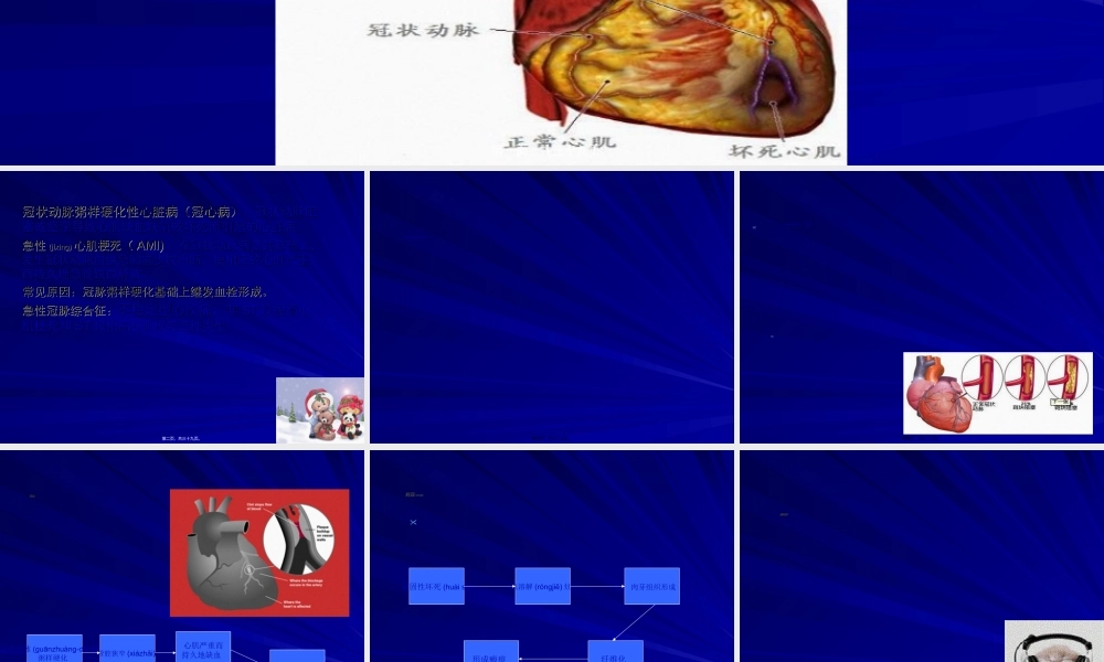 2022年医学专题—急性心肌梗死2.ppt