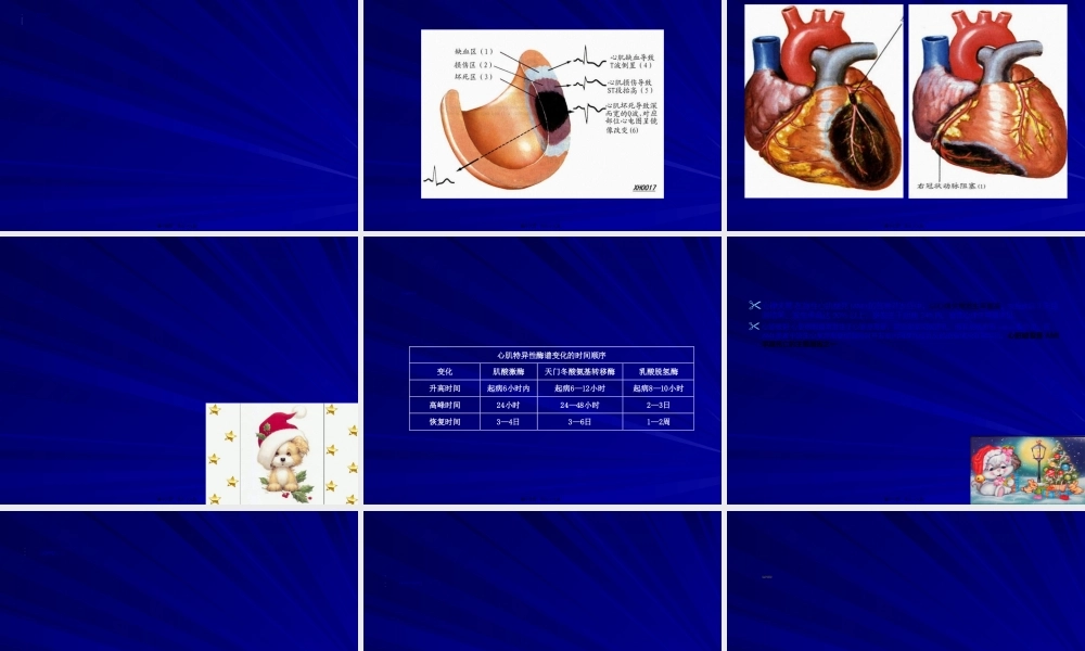 2022年医学专题—急性心肌梗死2.ppt