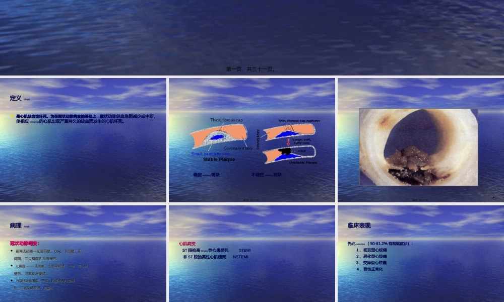 2022年医学专题—急性心肌梗死急诊教学详解.ppt