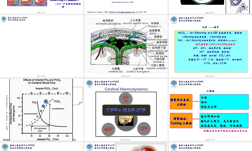 2022年医学专题—急性脑水肿与颅内高压--复旦儿科-陆国平-2018.ppt