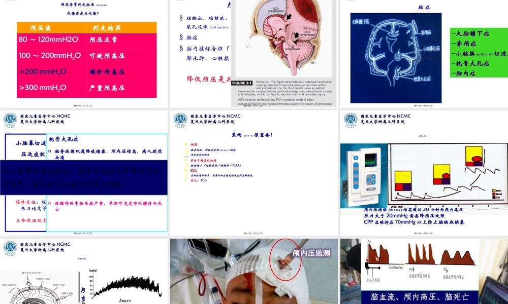2022年医学专题—急性脑水肿与颅内高压--复旦儿科-陆国平-2018.ppt