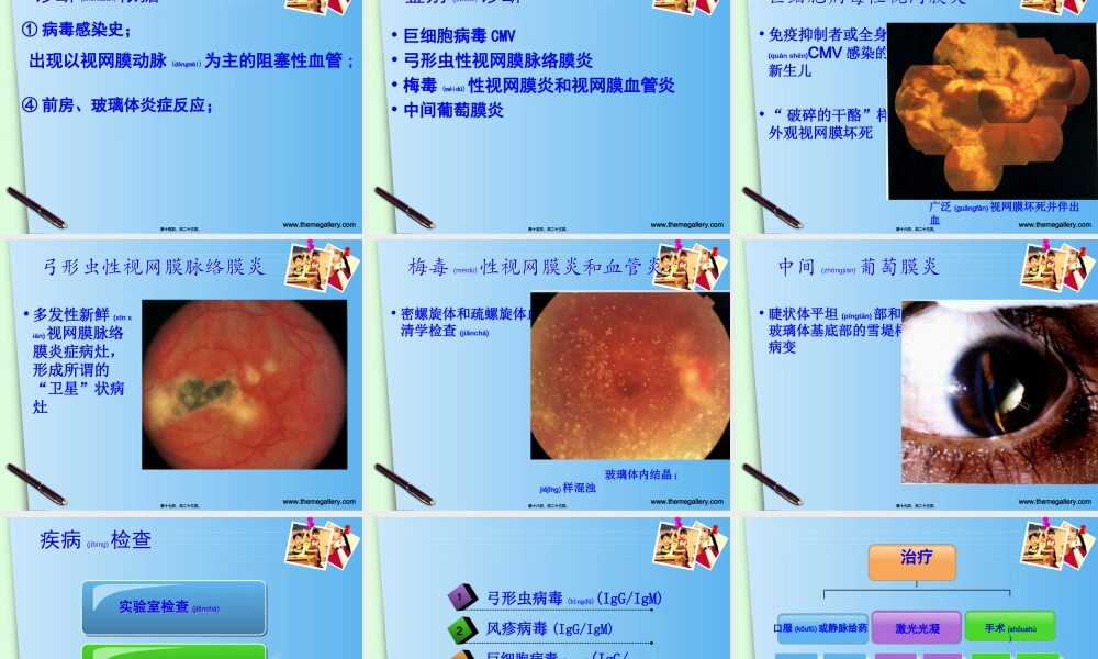 2022年医学专题—急性视网膜坏死综合症.ppt