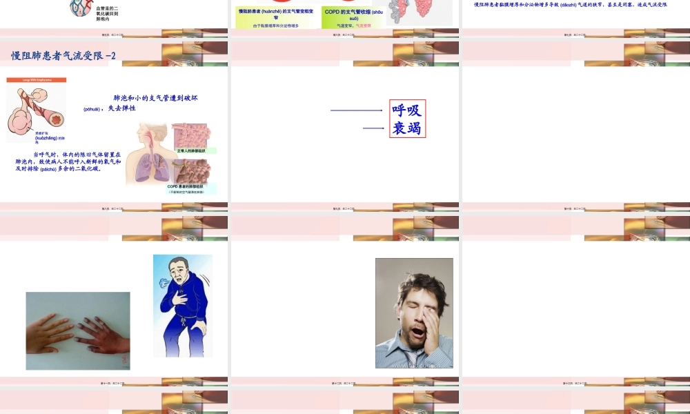 2022年医学专题—慢阻肺-呼吸衰竭.ppt