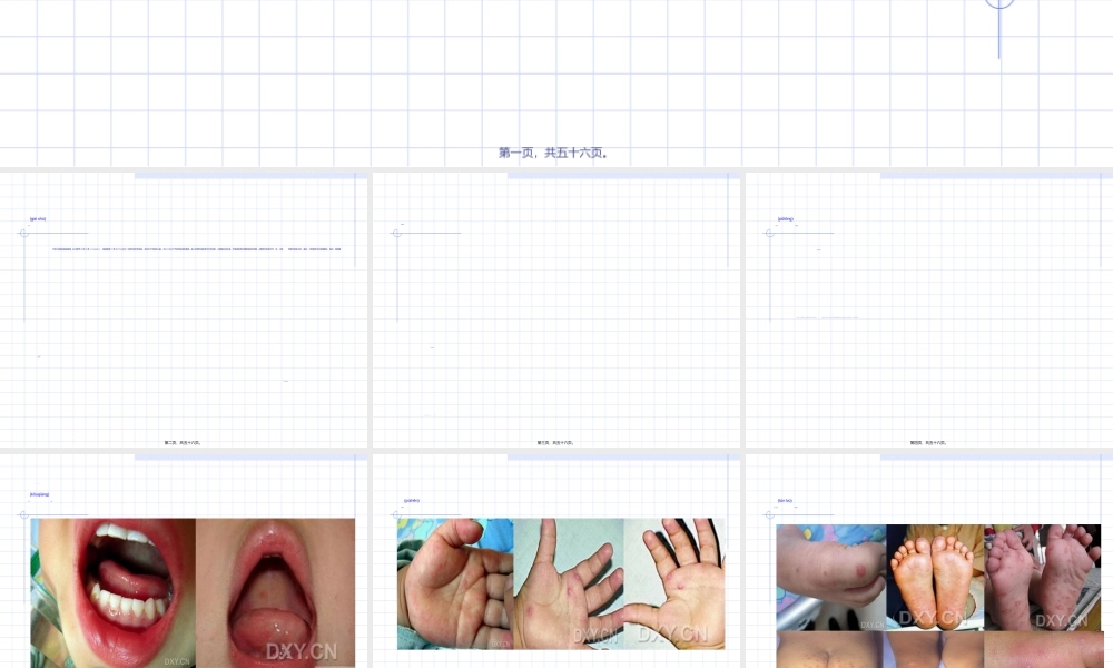 2022年医学专题—手足口病诊疗指南(2010年版版).ppt