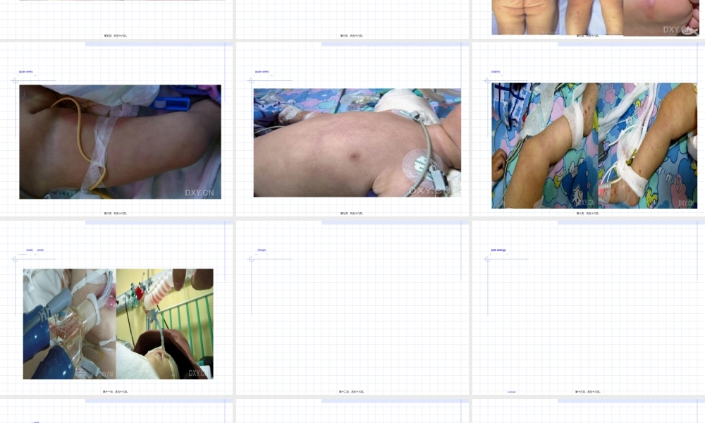 2022年医学专题—手足口病诊疗指南(2010年版版).ppt