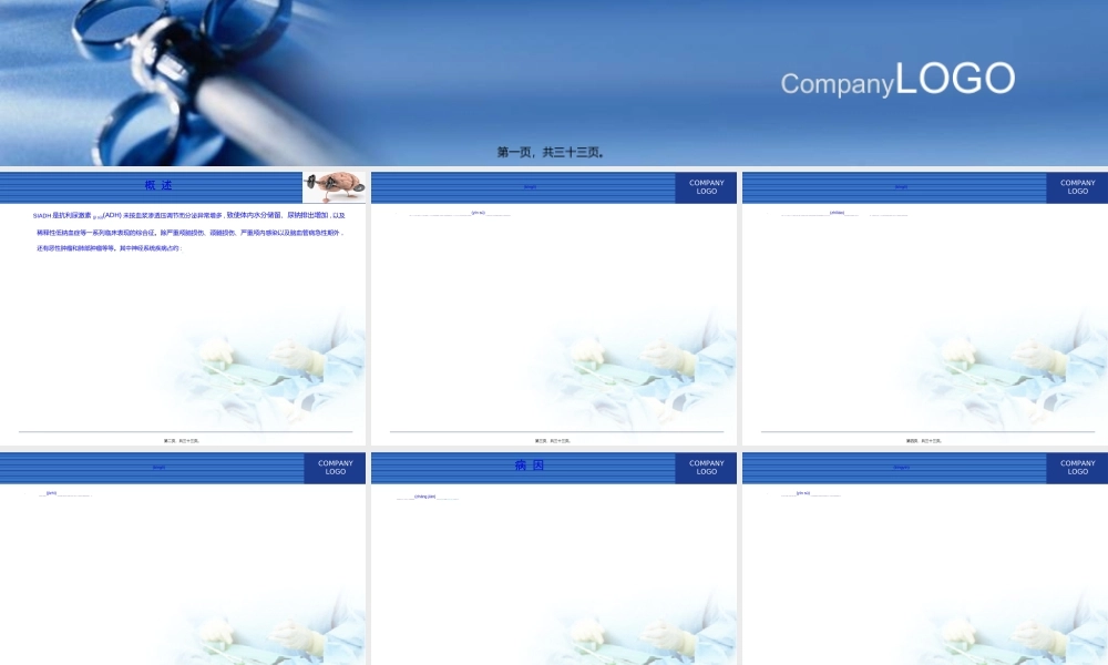 2022年医学专题—抗利尿激素分泌异常综合征.ppt