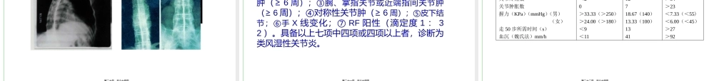 2022年医学专题—类风湿性关节炎的诊治(1).ppt