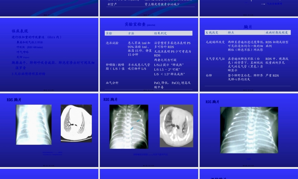 2022年医学专题—新生儿呼吸窘迫综合征5.ppt