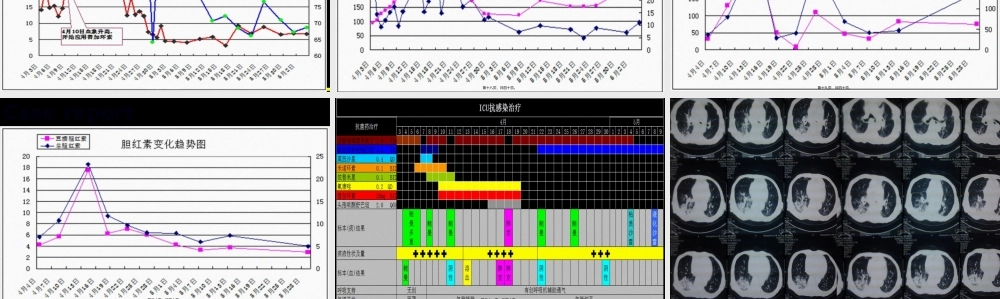 2022年医学专题—替加环素病例分享.ppt