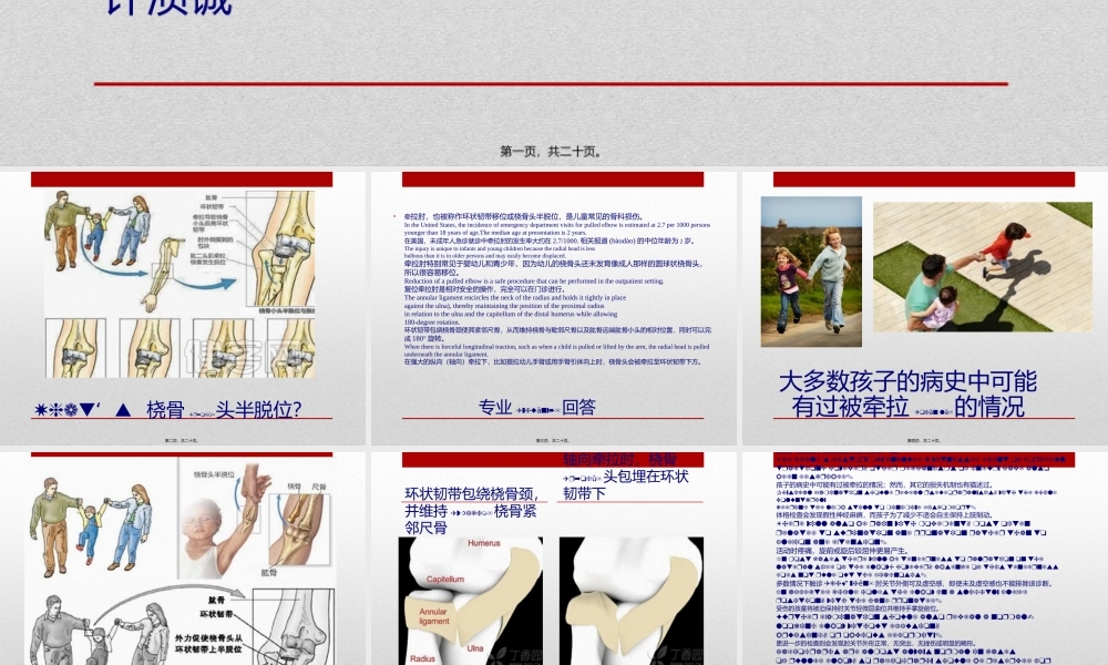 2022年医学专题—桡骨小头半脱位.pptx