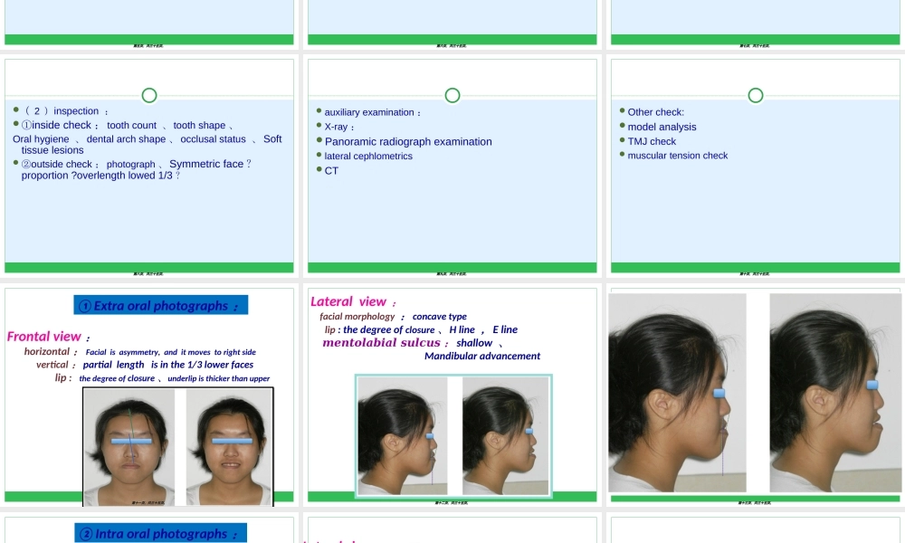 2022年医学专题—正畸病例分析英文版.ppt