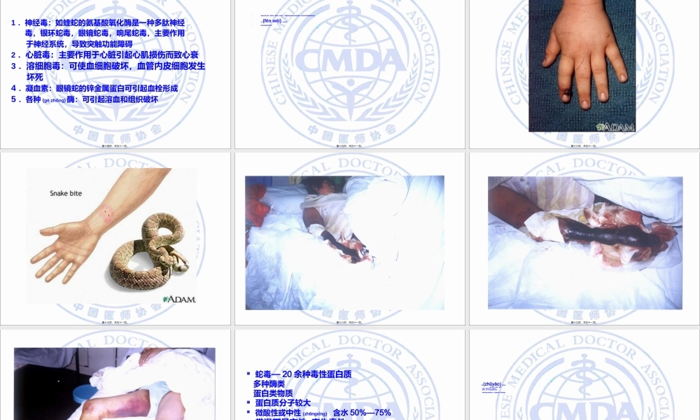 2022年医学专题—毒蛇咬伤的急救.ppt