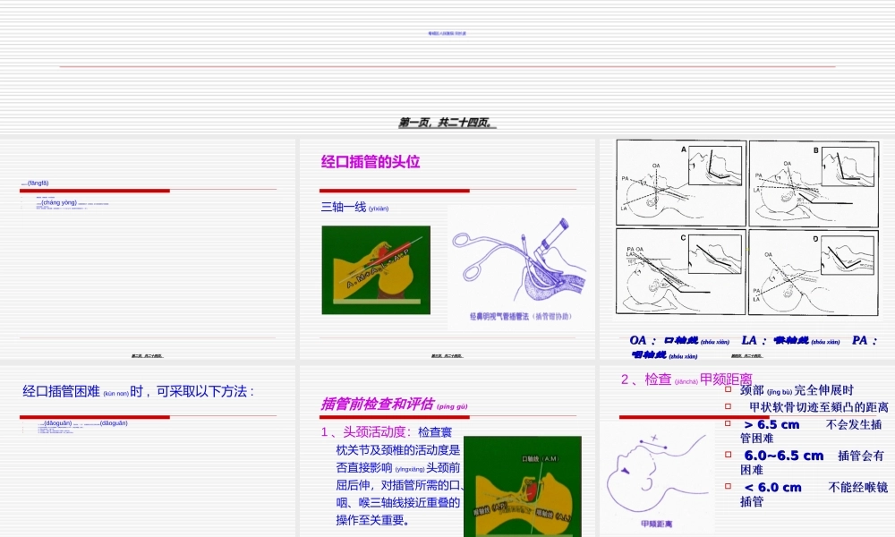 2022年医学专题—气管插管评估.ppt