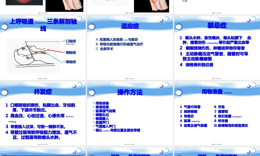 2022年医学专题—气管插管术-祁林PPT.pptx