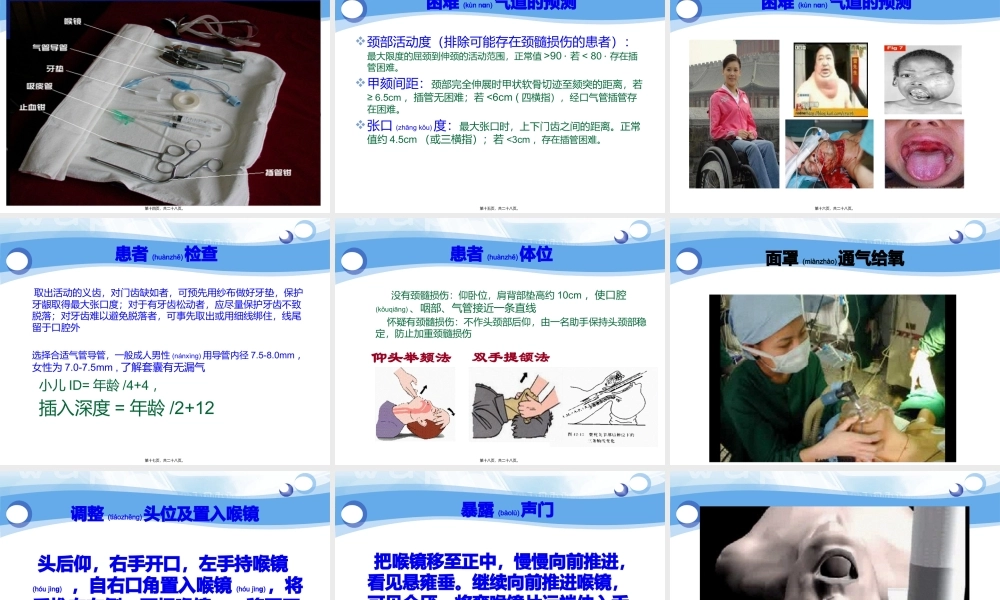 2022年医学专题—气管插管术-祁林PPT.pptx