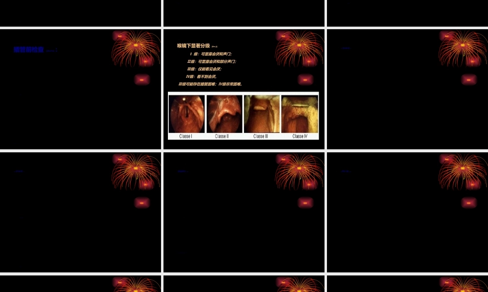 2022年医学专题—气管插管术马磊.ppt