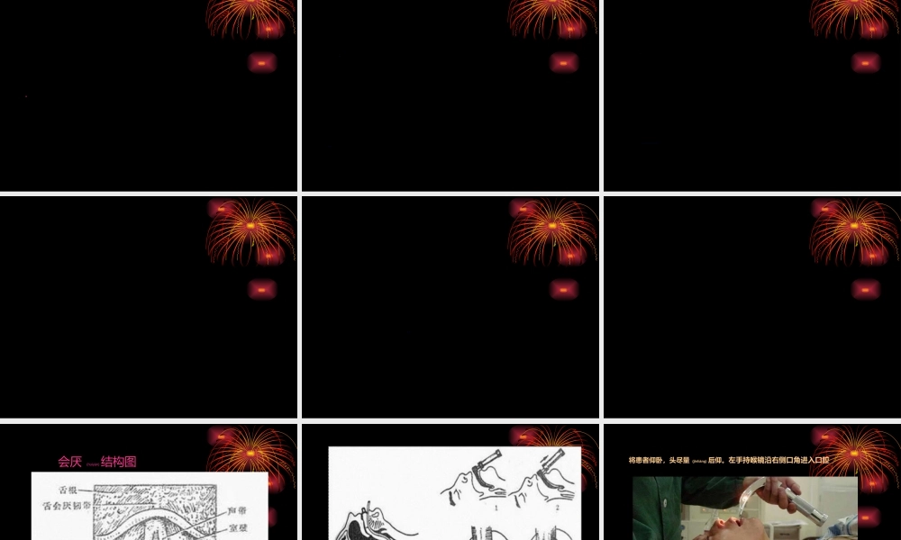 2022年医学专题—气管插管术马磊.ppt