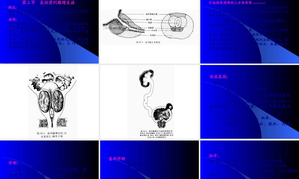 2022年医学专题—泌尿系梗阻.ppt