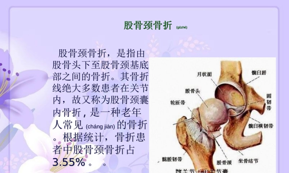 2022年医学专题—浅谈股骨颈骨折幻灯.ppt