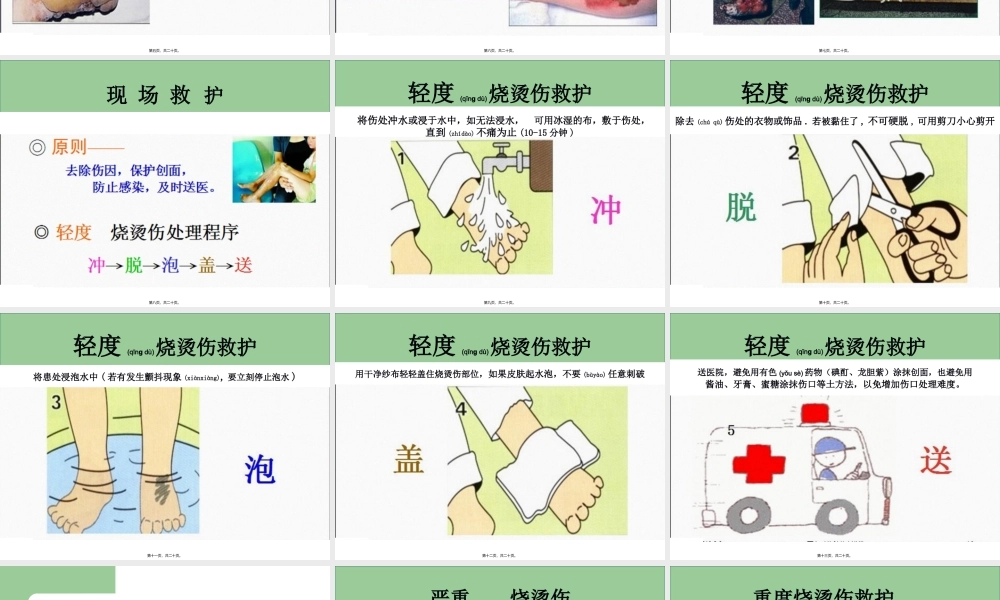 2022年医学专题—烧烫伤急救处理.ppt