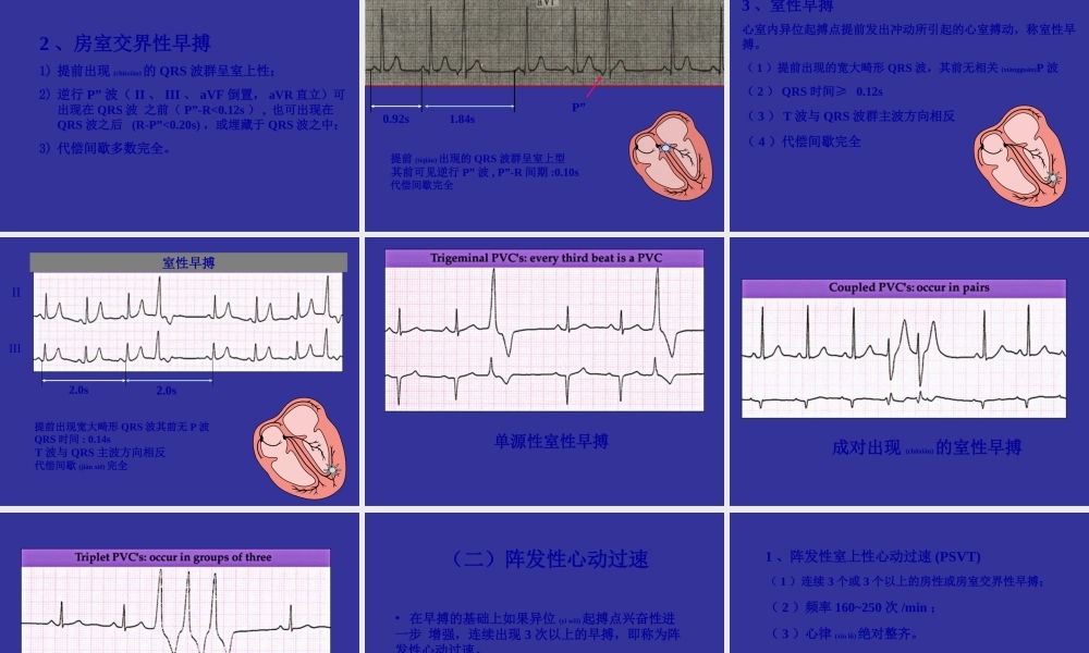 2022年医学专题—爱爱医资源-协和医科大学心电图详解-2.ppt