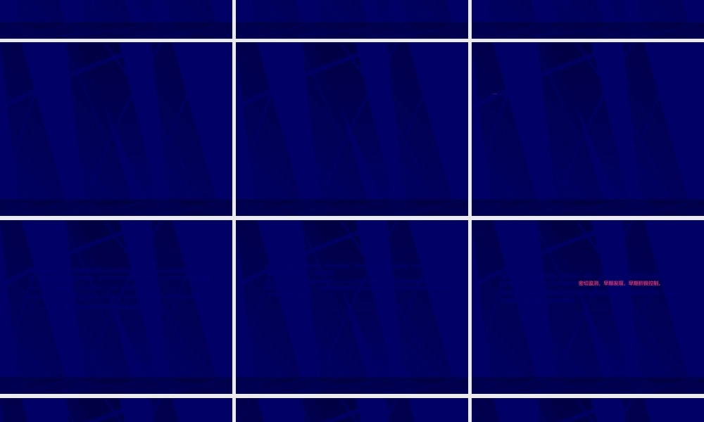 2022年医学专题—狼疮脑病.ppt