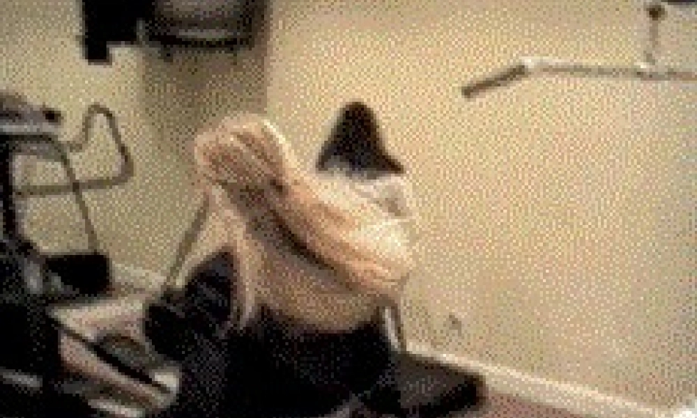 2022年医学专题—疼痛.ppt