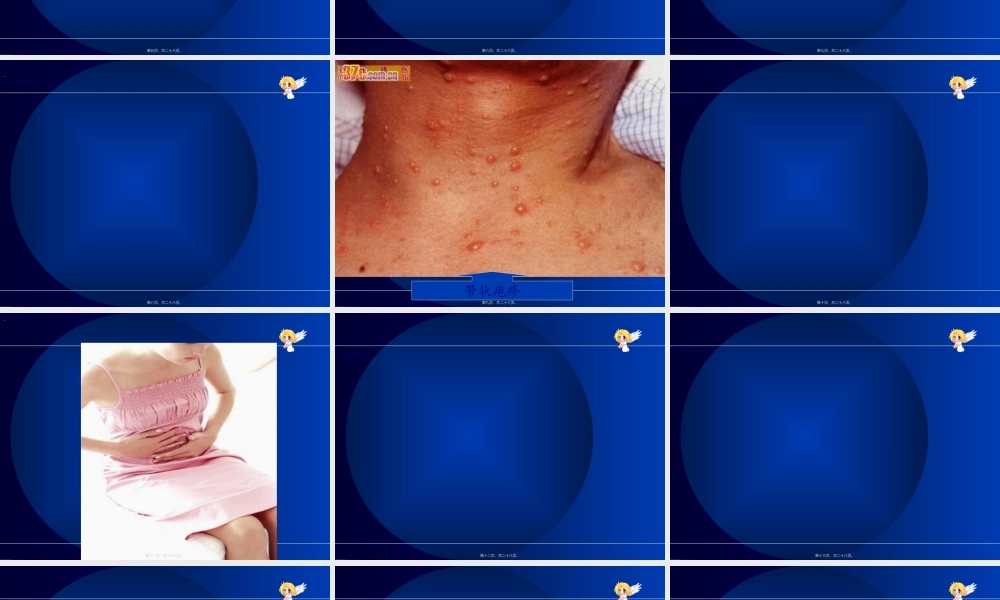 2022年医学专题—疼痛.ppt