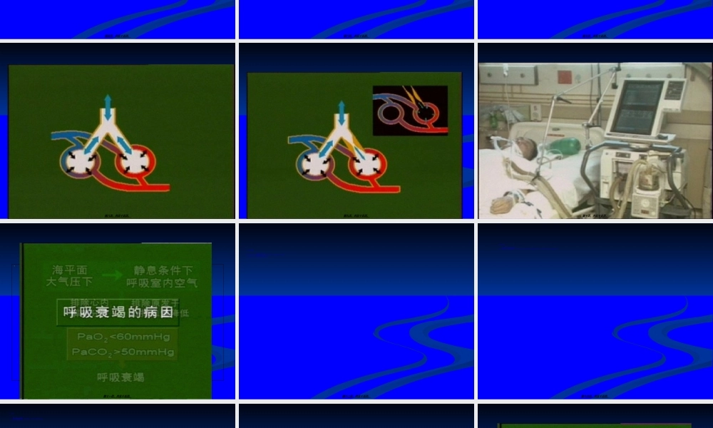 2022年医学专题—病因与发病机制.ppt