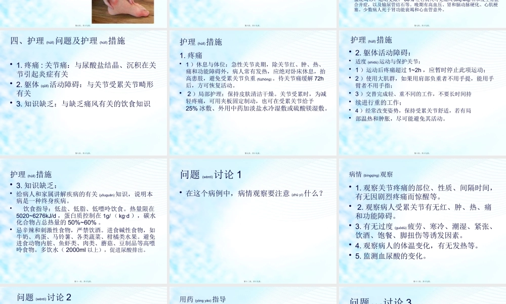 2022年医学专题—痛风教学pptx.pptx