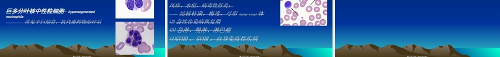 2022年医学专题—白细胞计数与分类.ppt