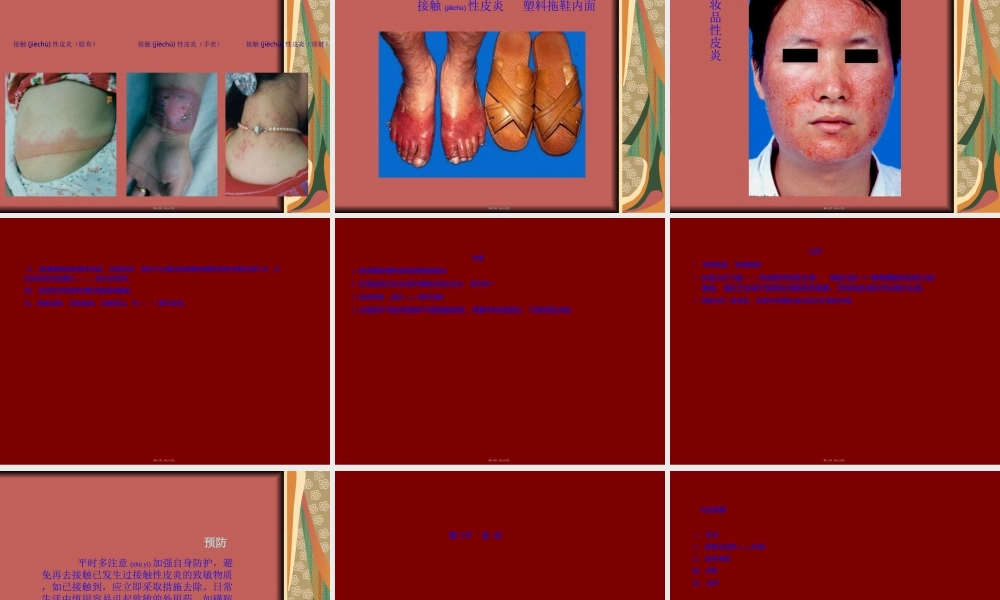 2022年医学专题—皮炎与湿疹.ppt