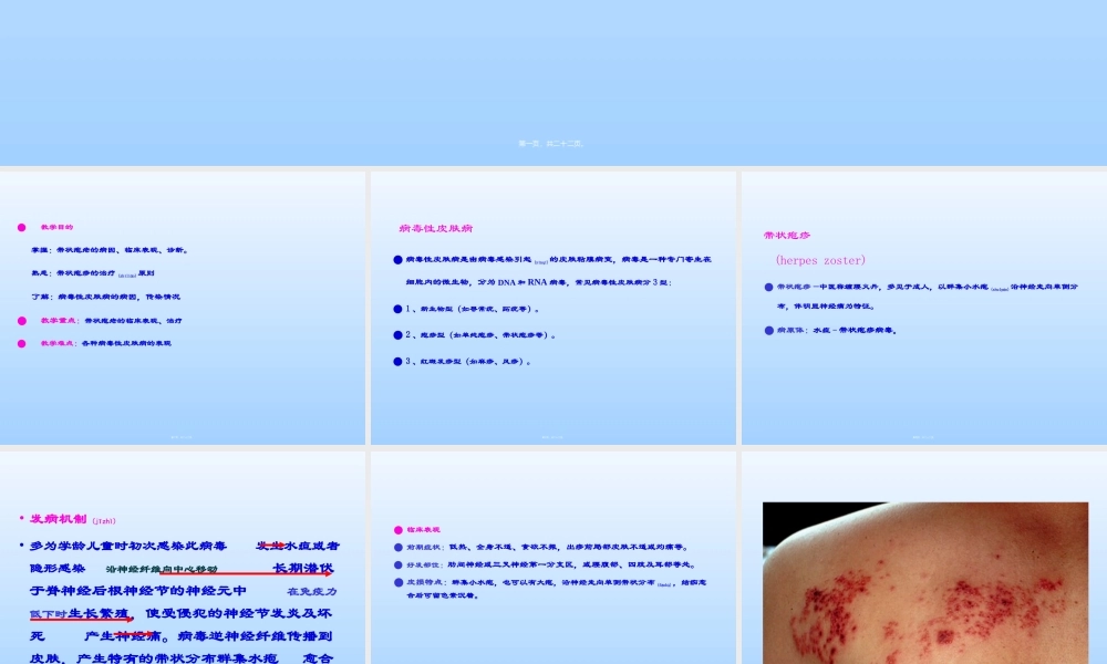 2022年医学专题—皮肤性病学——带状疱疹.ppt