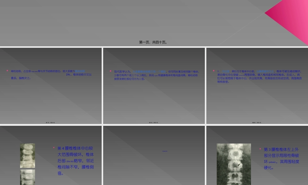 2022年医学专题—第二节-骨关节结核.ppt