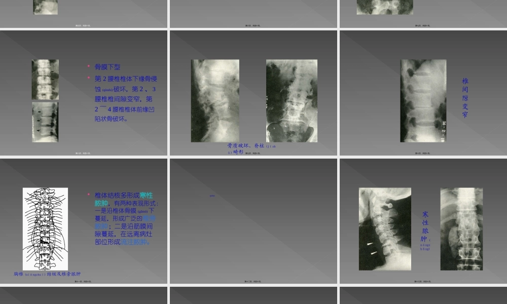 2022年医学专题—第二节-骨关节结核.ppt