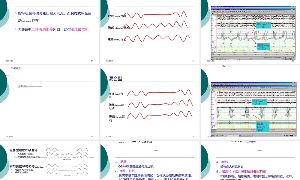 2022年医学专题—第十三章--睡眠呼吸暂停低通气综合征.ppt