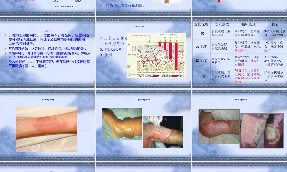 2022年医学专题—第十三节、烧伤.ppt