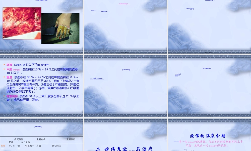 2022年医学专题—第十三节、烧伤.ppt