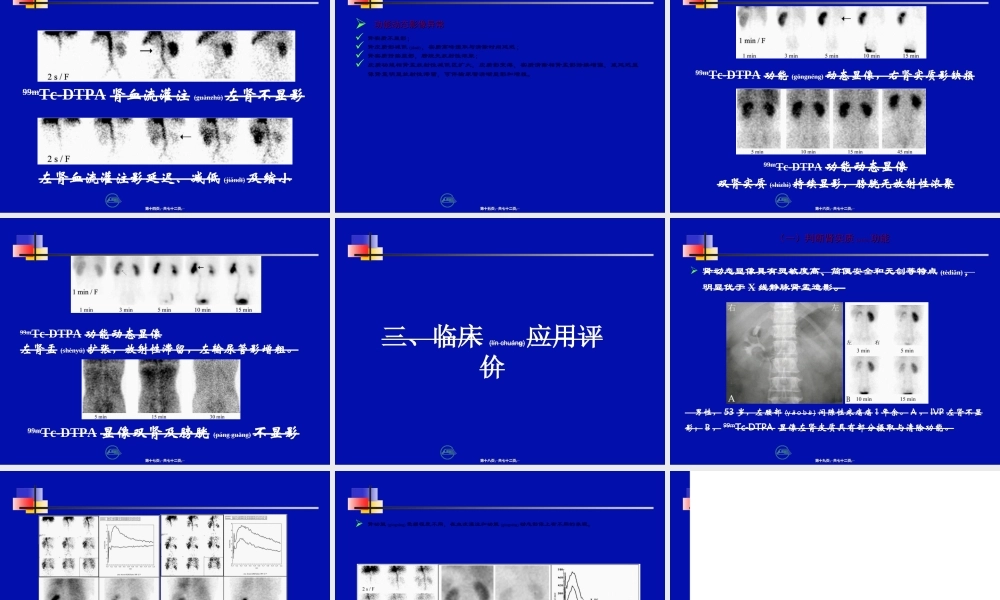2022年医学专题—第十五节-泌尿系统.ppt