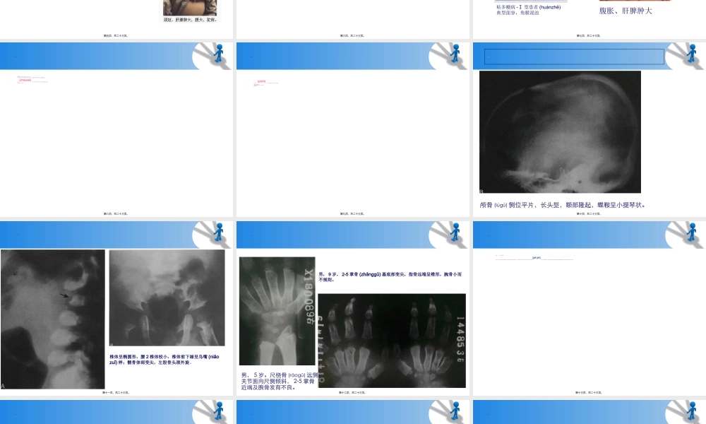 2022年医学专题—粘多糖贮积症.ppt