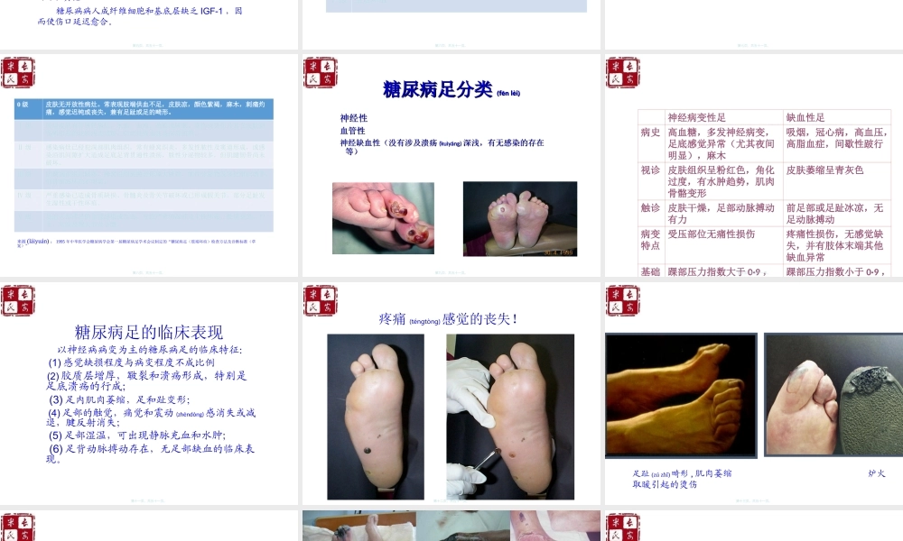 2022年医学专题—糖尿病足中西医结合诊疗.ppt