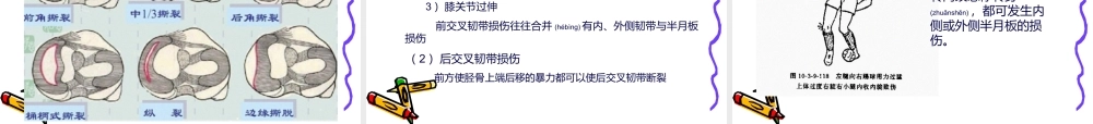 2022年医学专题—系解pbl--膝关节.ppt