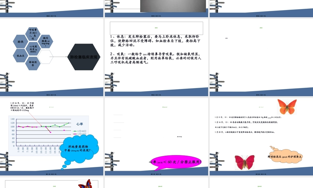 2022年医学专题—系统性红斑狼疮病例讨论.ppt