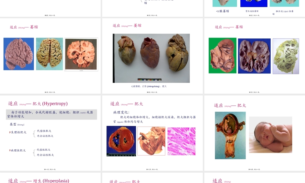 2022年医学专题—细胞和组织的适应与损伤-2.ppt