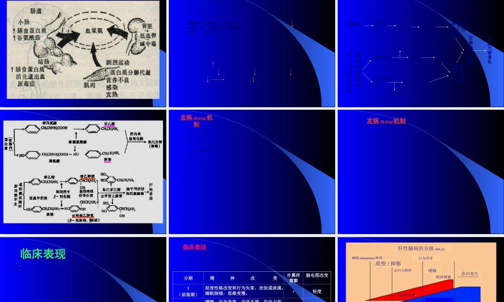 2022年医学专题—肝性脑病lidan.ppt