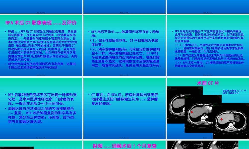 2022年医学专题—肝癌射频消融术后影像评价.pptx