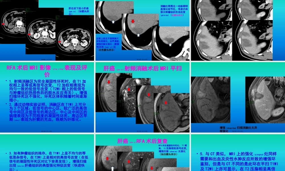 2022年医学专题—肝癌射频消融术后影像评价.pptx