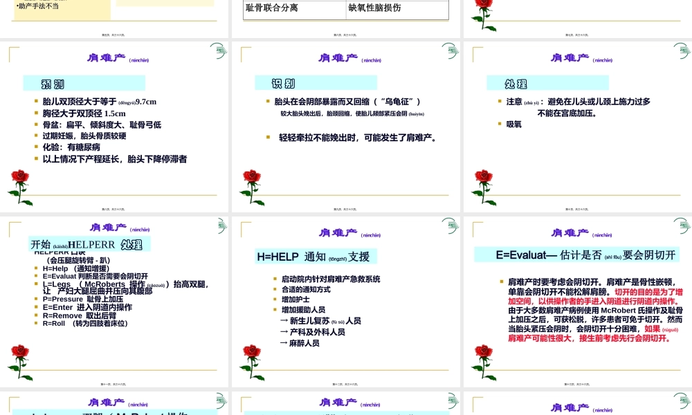 2022年医学专题—肩难产及软产道损伤缝合.ppt